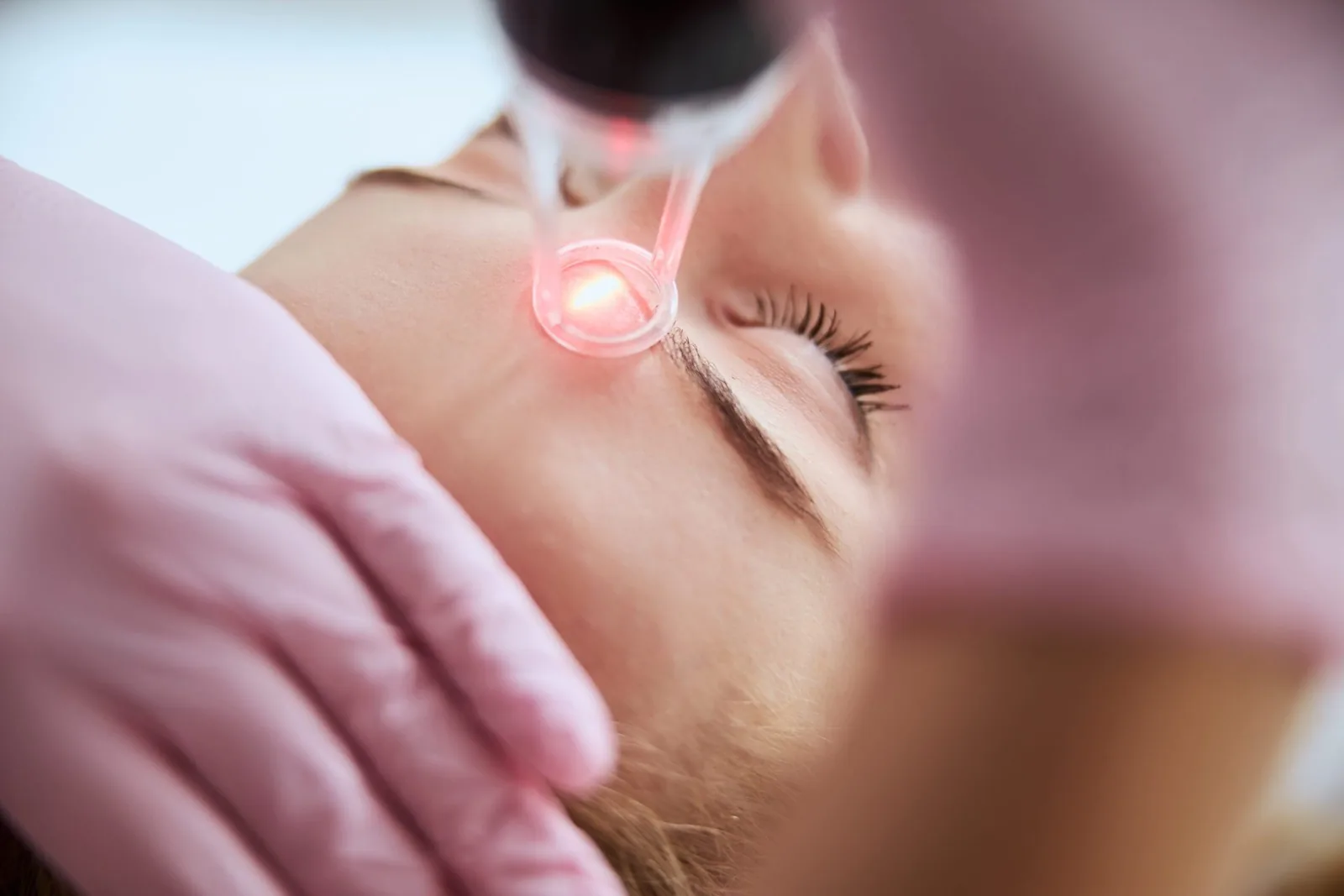 A pink-gloved hand holding a glowing laser handpiece to a reclining woman's forehead